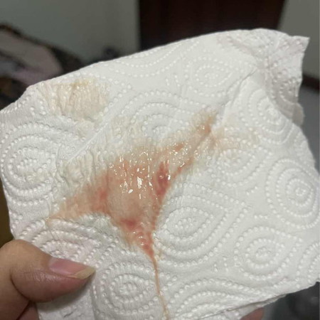 แบบนี้ใช่มูกเลือดไหม
