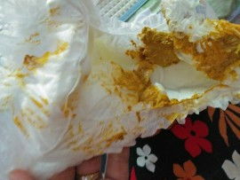 Maaf sensitif pup bayi keras dan anus lecet