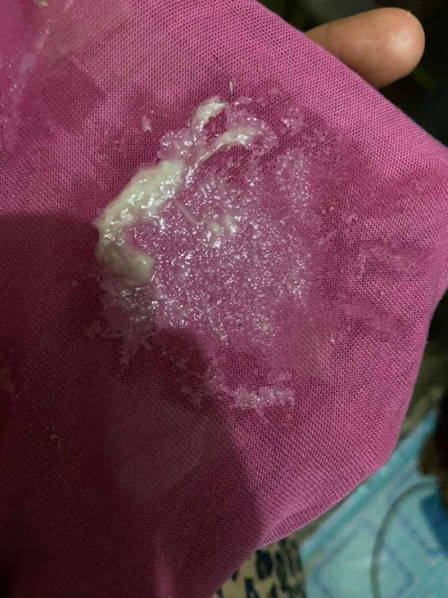 Bun ada gak yang sama 34week