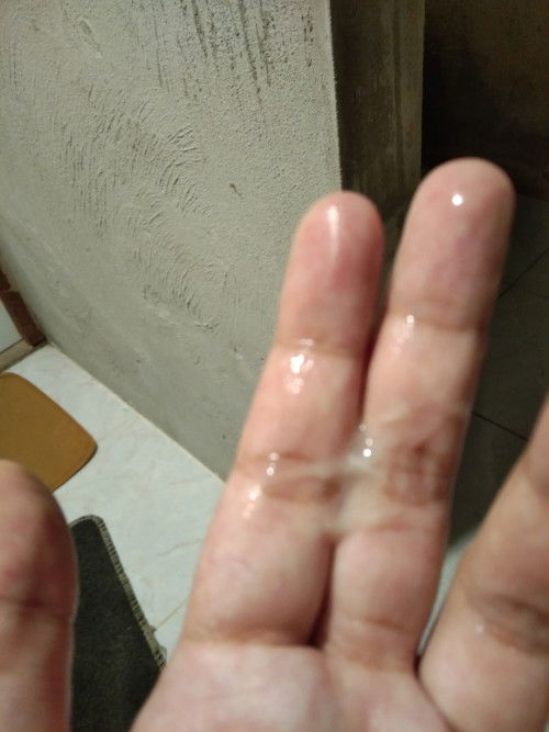 แบบนี้ใช่มูกไหมคะแม่ๆ ช่วยตอบหน่อยนะคะเราอยากรู้มาก แล้วต้องไปโรงบาลไหมคะ 36+6