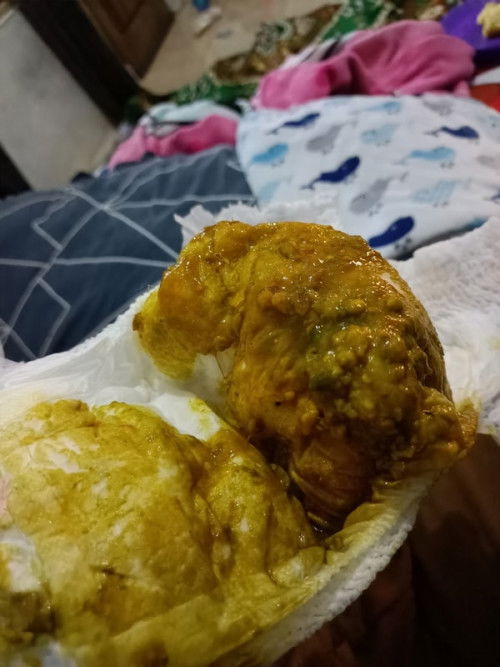 Bayi 13 bulan pup mencret bau amis sudah seminggu