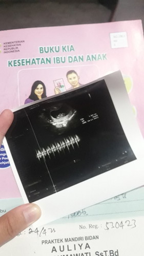bun saya hmil 11w tapi nggak kerasa apa2 & perut rata, apakah wajar ? Trakhir usg janin sehat