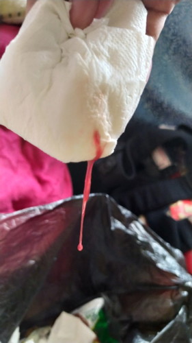 Mucus plug na po ba ito bat paramg ang red na red po, simula pa kahapon gang ngayong umaga meron