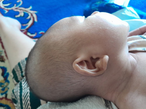 Kepala peyang