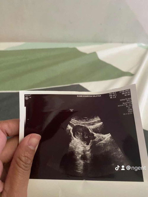 Positif palsu atau keguguran?