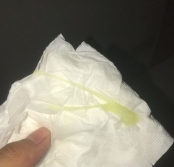 ท้อง35+3 ท้องแรก