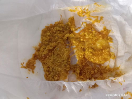 อุจจาระลูกมีมูกออกมาแบบนี้ผิดปกติไหมคะแม่แม่ น้องกินนมผงคะ