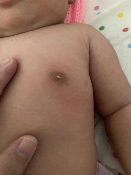 นมลูกเป็นแบบนี้  เราต้องทำอะไรไหมคะ  หรือมันจะหายไปเอง