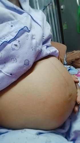 กลัวการคลอดลูก