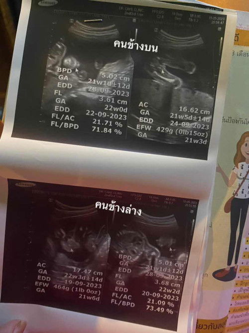 เเม่ๆช่วยดูหน่อยคนข้างบนผู้ชายหรือผู้หญิง😅