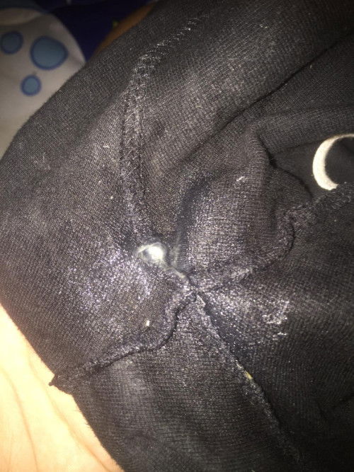 มีมูกแบบนี้ควรไปหาหมอไหมค่ะ