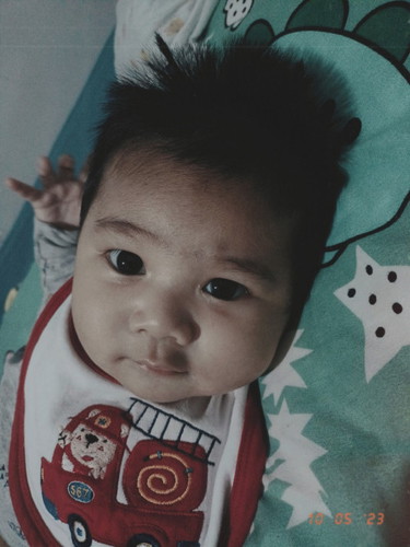 สอบถามเรื่องผมลูกค่ะ