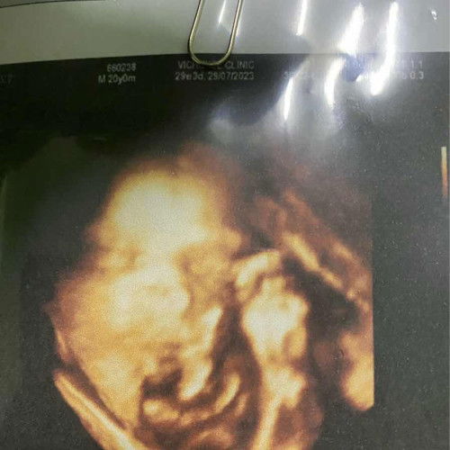 น้อง29+5 นน 1391 น้อยไปมั้ยคะแม่ๆ