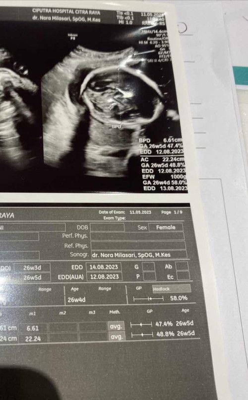 Hasil usg seperti wajah