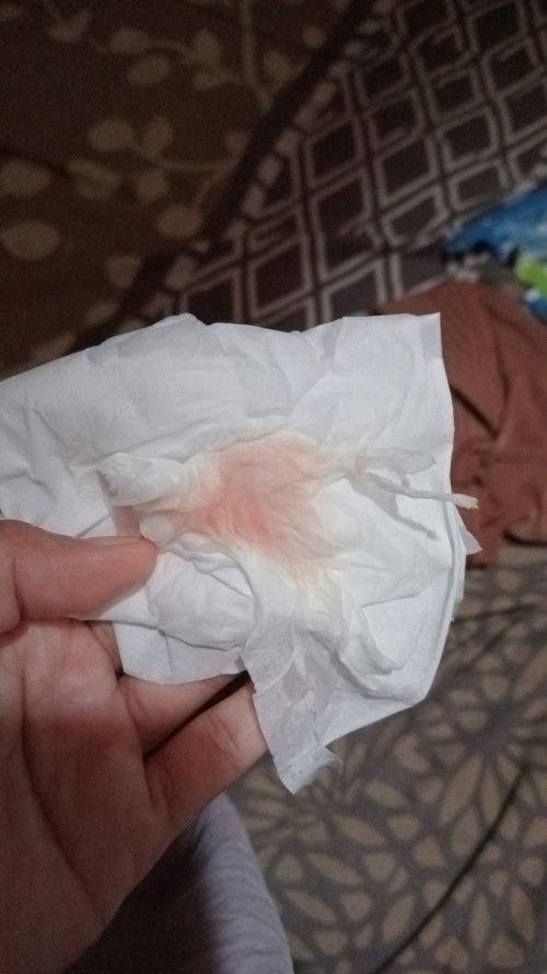 MW tanya sama bunda bunda disini...