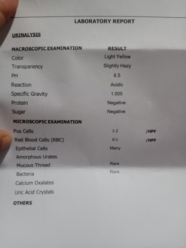 baka po meron marunong dito magbasa ng lab result