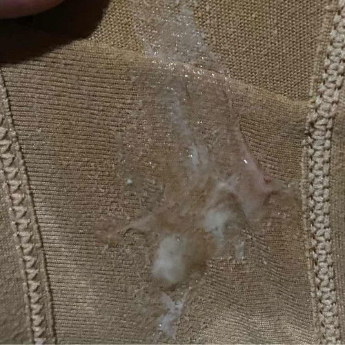 keluar lendir sama seperti darah