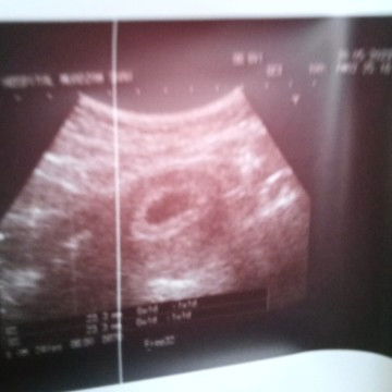 Doakan kandungan saya menjadi dan selamat.ikut kan baru 6 week tapi hari ni keluar darah sikit.