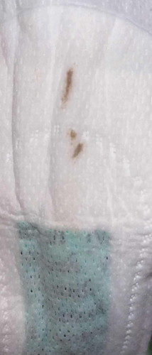 Mau nanya mom kira kira itu darah implantasi atau haid ya