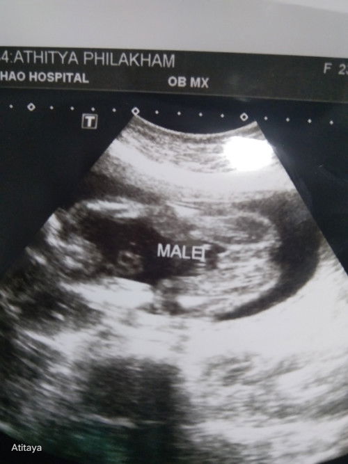 ดูเพศน้องหน่อย