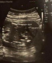 Sa tingin nyo po baby boy po talaga mga mams🙏🙏