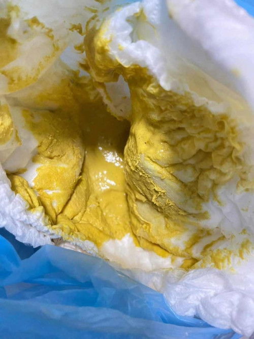 น้อง3เดือนกินนมผงถ่ายเหลว