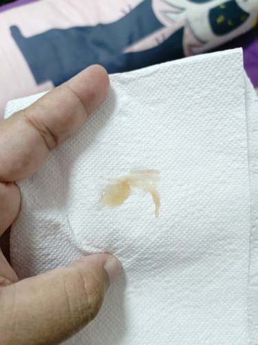 สอบถามอาการ 39 วีคค่ะ