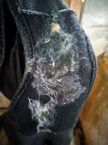 40+2wแบบนี้ใช่มูกไหมคะ