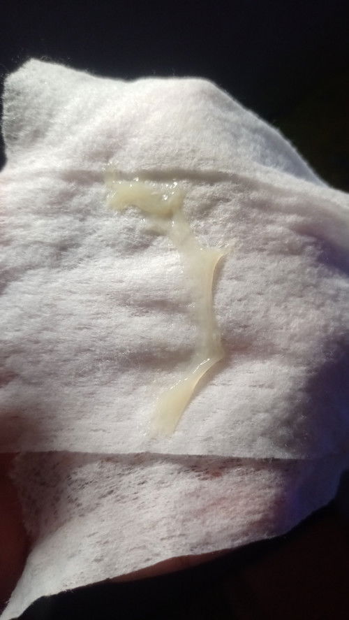 Mucus plug or discharge?.. 3cm na nung last visit kay ob..