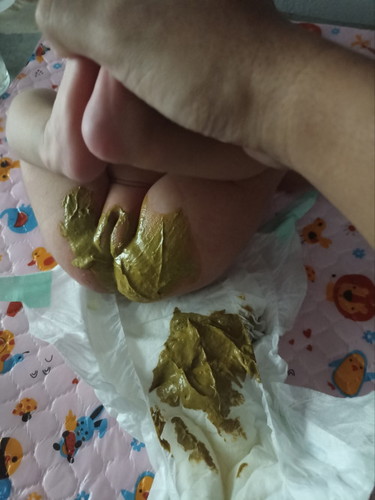 ขออภัย อึลูก