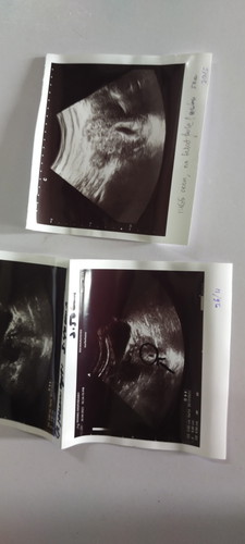Baby Tak Nampak