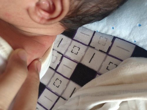 ลูกมีจุดแดงแบบนี้ทำไงคะ