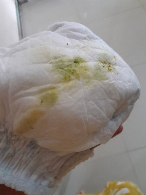 Suhu tubuh bayi 3 bulan