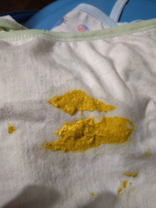 Bun maaf jorok kalau pup begini diare atau bukan ya. Anak saya sufor