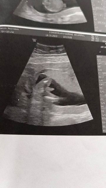 ช่วยดูเพศหน่อยคะหญิงหรือชายคะ😊