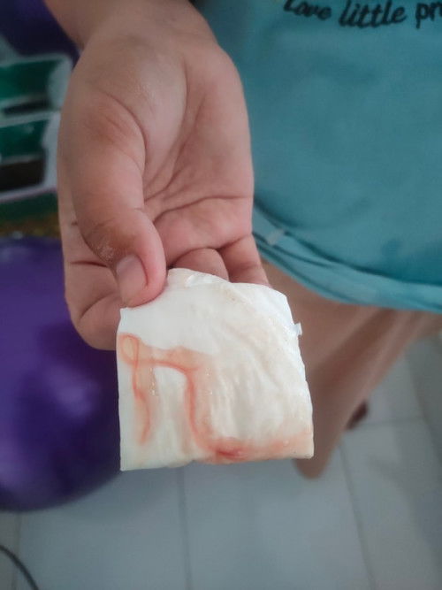 Keluar flek lendir darah