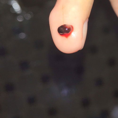 Kehamilan atau Keguguran