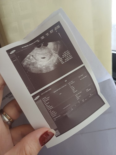 Normal lang ba na 6weeks & 2days akong pregnant tas wala pa laman yung lalagyanan ng bata? Pasagot
