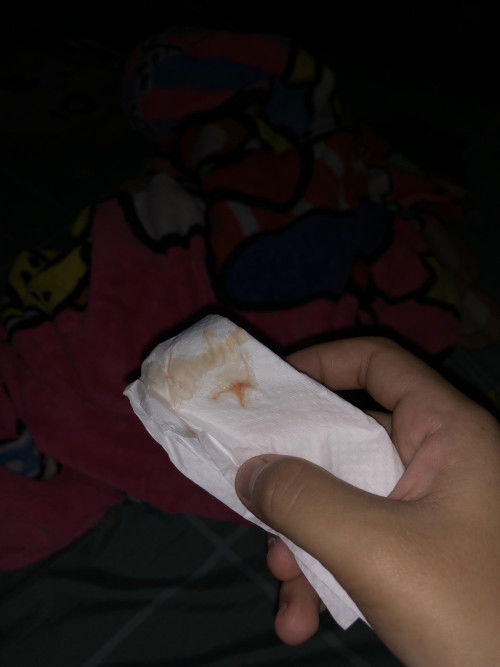 อาบน้ำเสร็จมีมูกเลือดออกแบบนี้ แต่ไม่มีอาการปวดท้องร่วมด้วย