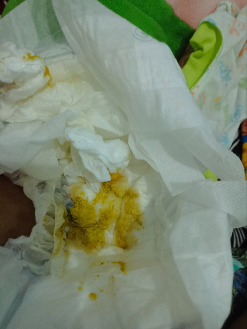 Fases bayi saya usia 5bulan kayak gitu kira* gmna ya ,trs bab 5x lebih tpi gk panas gk maul