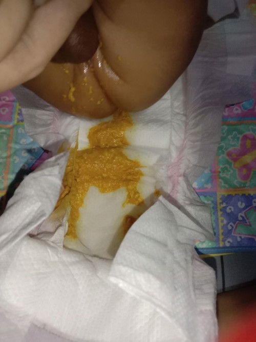 Poop color and texture