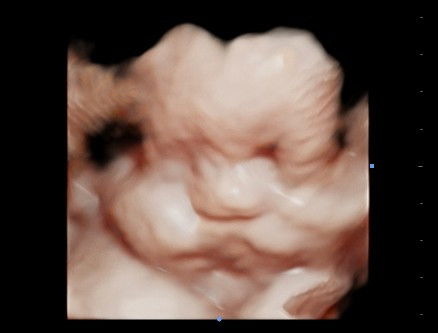 MASYA ALLAH .. TABARAKALLAH ..