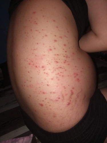 Mga mommies normal lang ba magkaganito ang mga buntis? 7months pregnant po ako ngayun