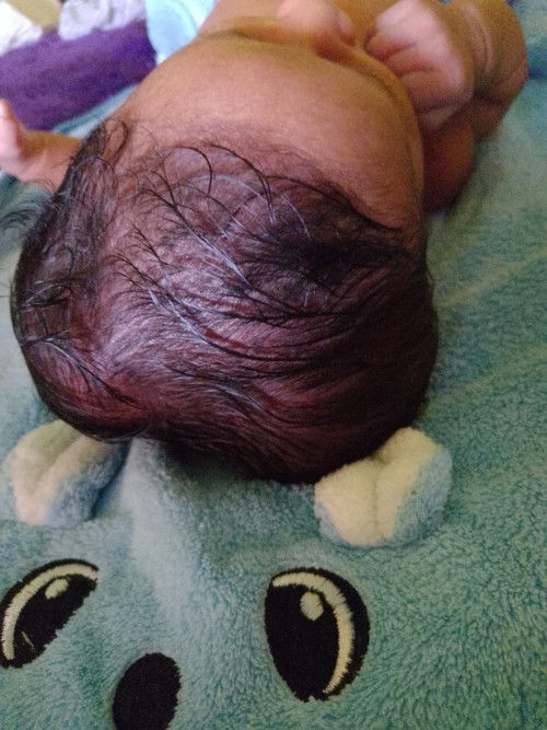 Kepala bayi 2 minggu