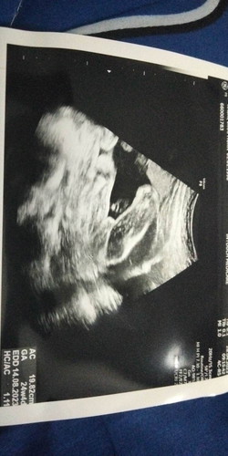 ซาวด์เพศลูก 28 W