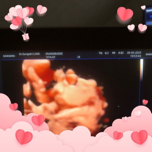 โชว์หน้าน้องกันหน่อยค่ะแม่ๆ ทีมกรกฎา66