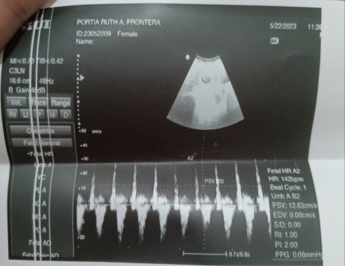 Heartbeat