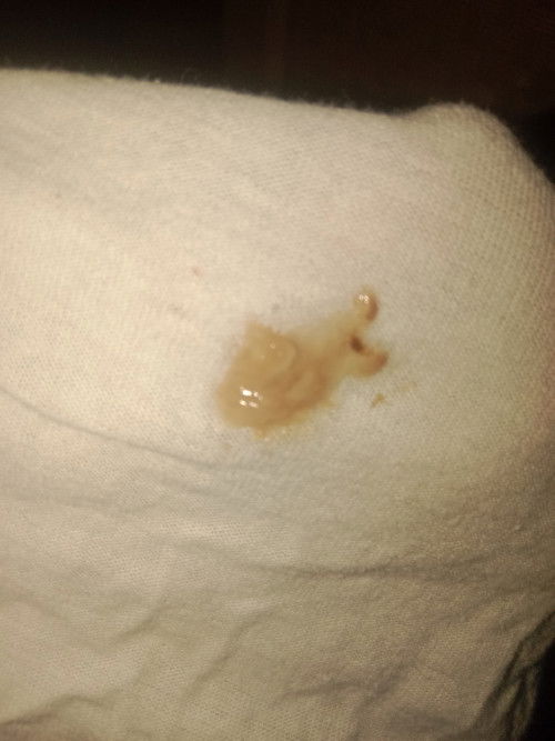 Ini tanda mau melahirkah kah atau apa ya... Uk39 minggu lbh 2 hari