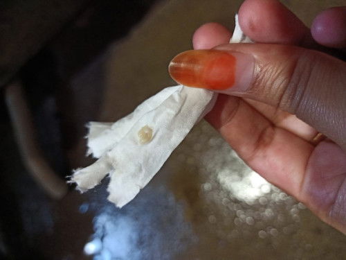 Keputihan terus menerus