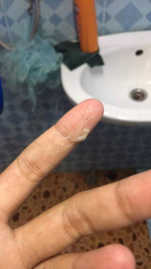 39+2 อยากทราบว่าใช่มูกมั้ยคะ